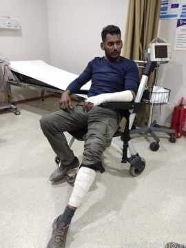 Tamil star Vishal injured while shooting for a chase sequence in Turkey